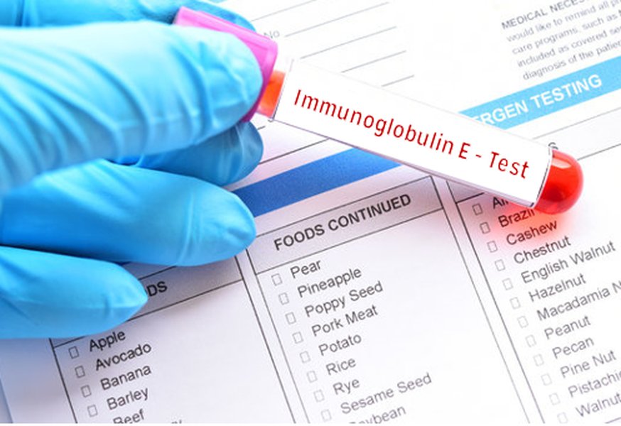 total-immunoglobulin-e-overview-ntl3xlxj