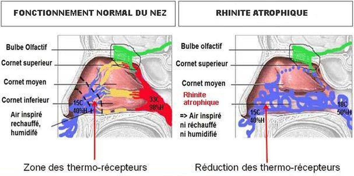 Schéma anatomique des fosses nasales montrant les cornets