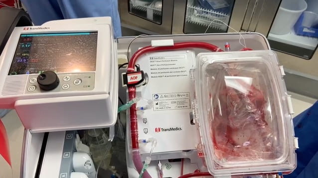 medical technology organ care system