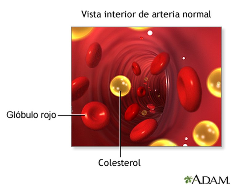 Proceso de aféresis de lipoproteínas.