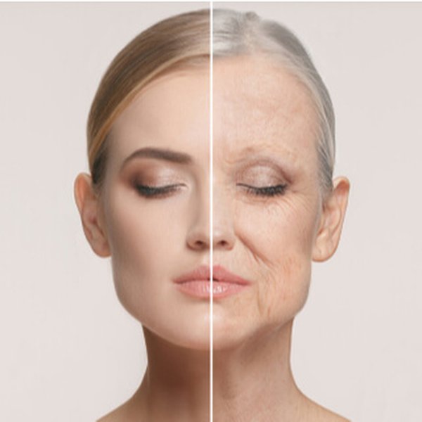 treating-skin-wrinkles-e6o0ztkc