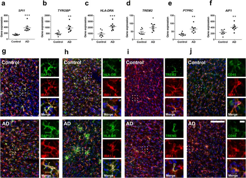 trem2-pu1-signaling-analysis-t1vaqerk