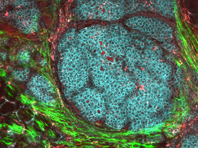 tumor tissue microenvironment microscope