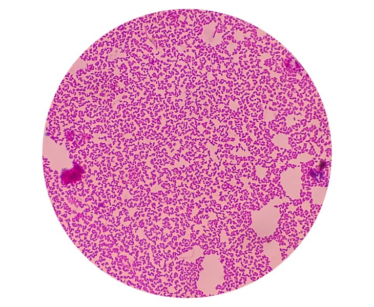 understanding-typhoid-fever-infection-b3aixyy7