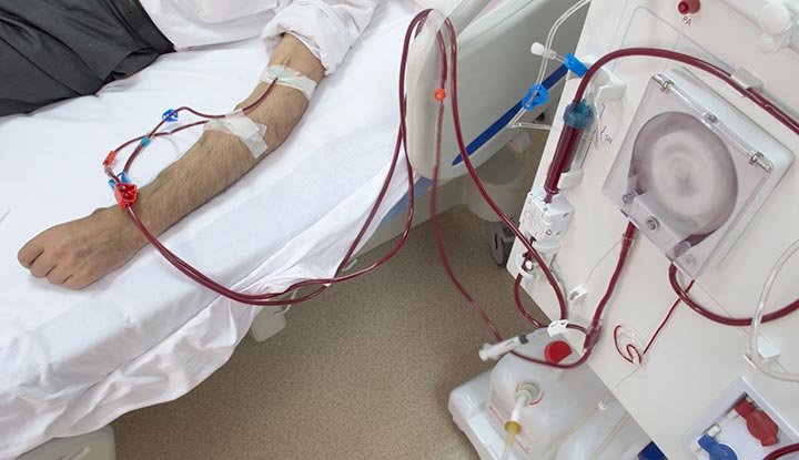 dialysis machine and kidney organ transplant setup