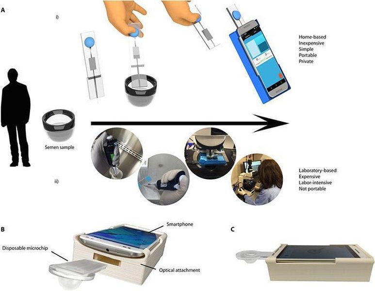 vasectomy-semen-centrifugation-necessity-rxgrgmoy