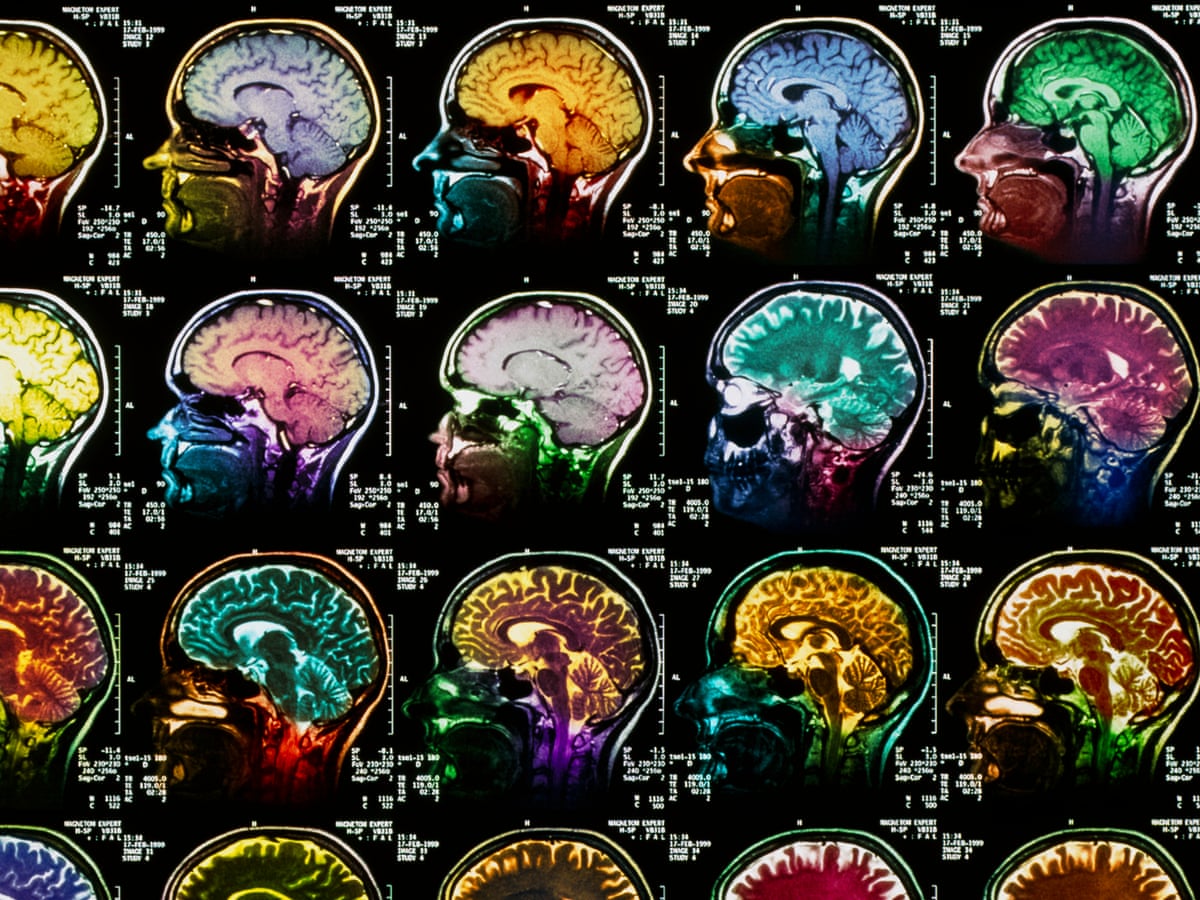 dreaming brain activity