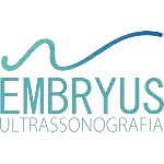 EMBRYUS ULTRASSONOGRAFIA