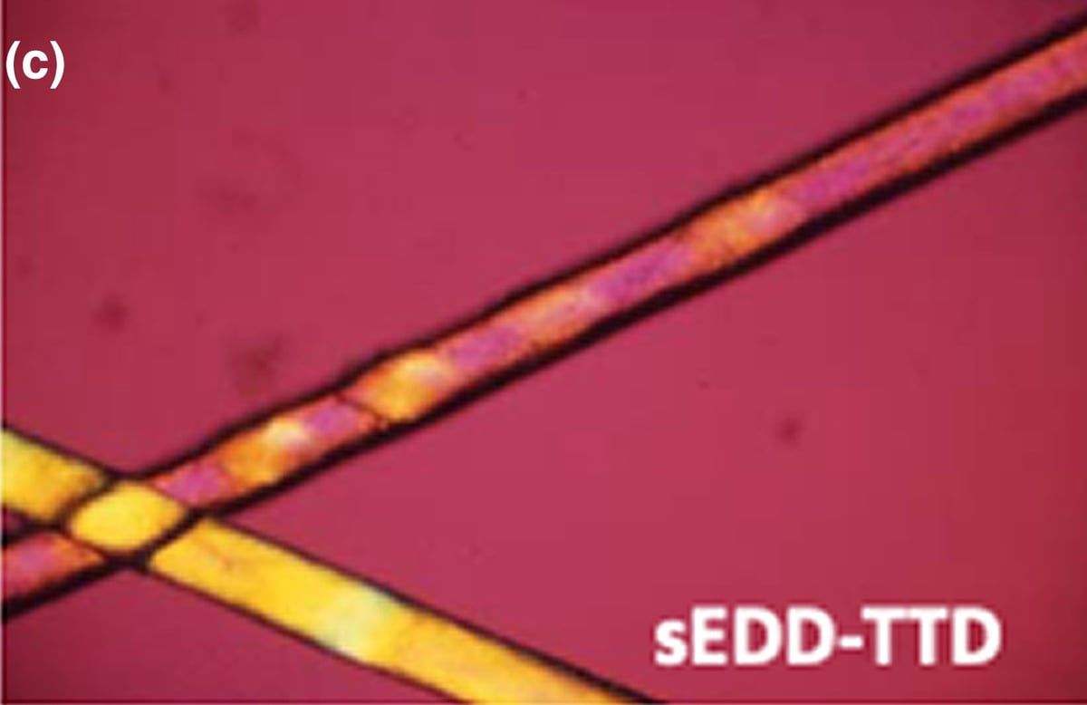MPLKIP-sEDD-TTD: sEDD-TTD (unspecified-sEDD-TTD): the hallmark of TTD is a pattern of light and dark bands (tiger tail banding) seen on the shaft with polarizing microscopy.