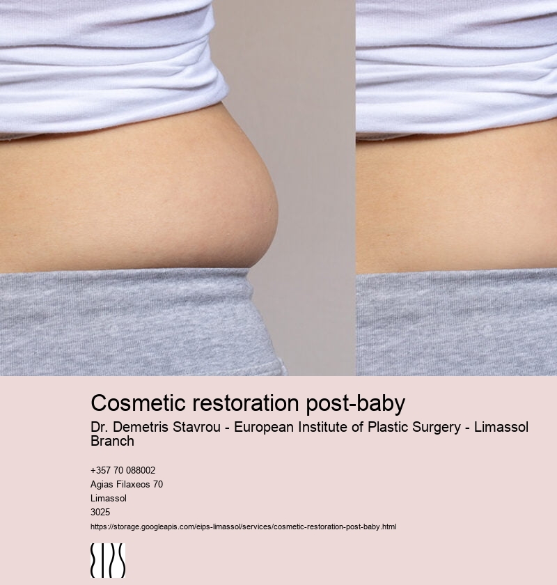 Mommy Makeover Cyprus