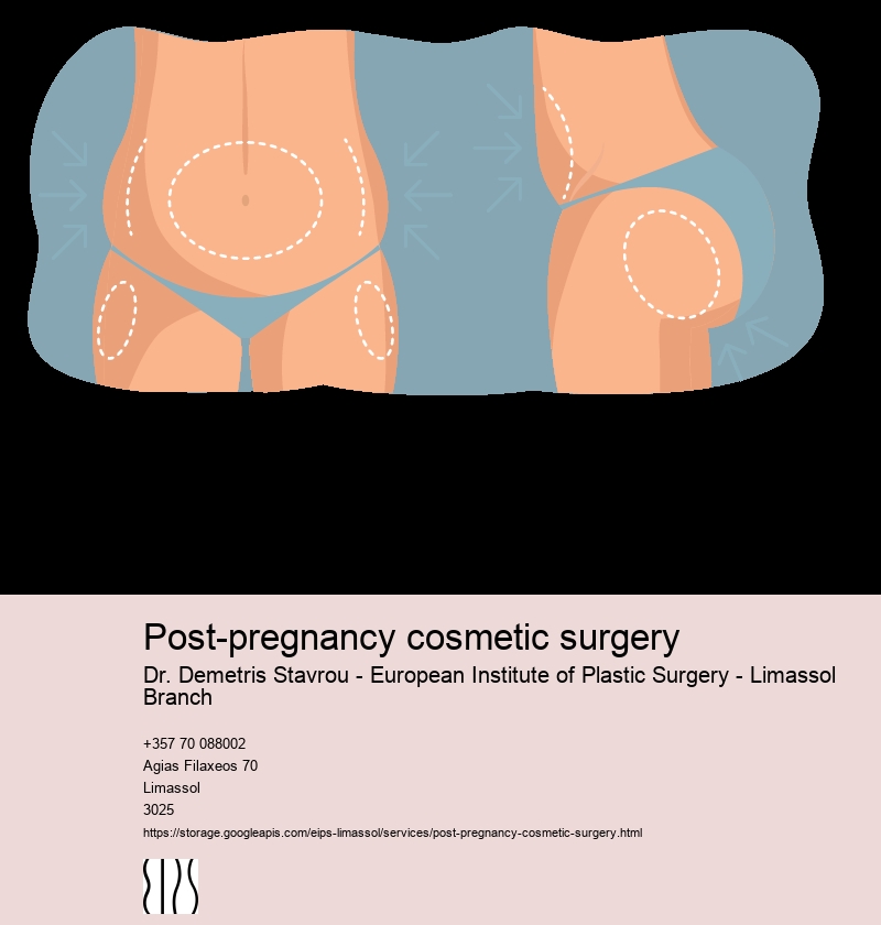 Mommy Makeover Cyprus