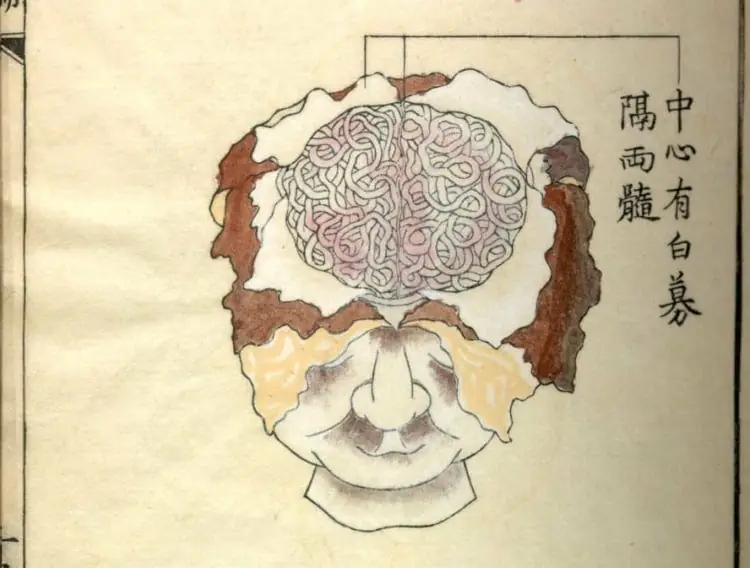 Neurodivergent Users Are Making AI Better for Everyone