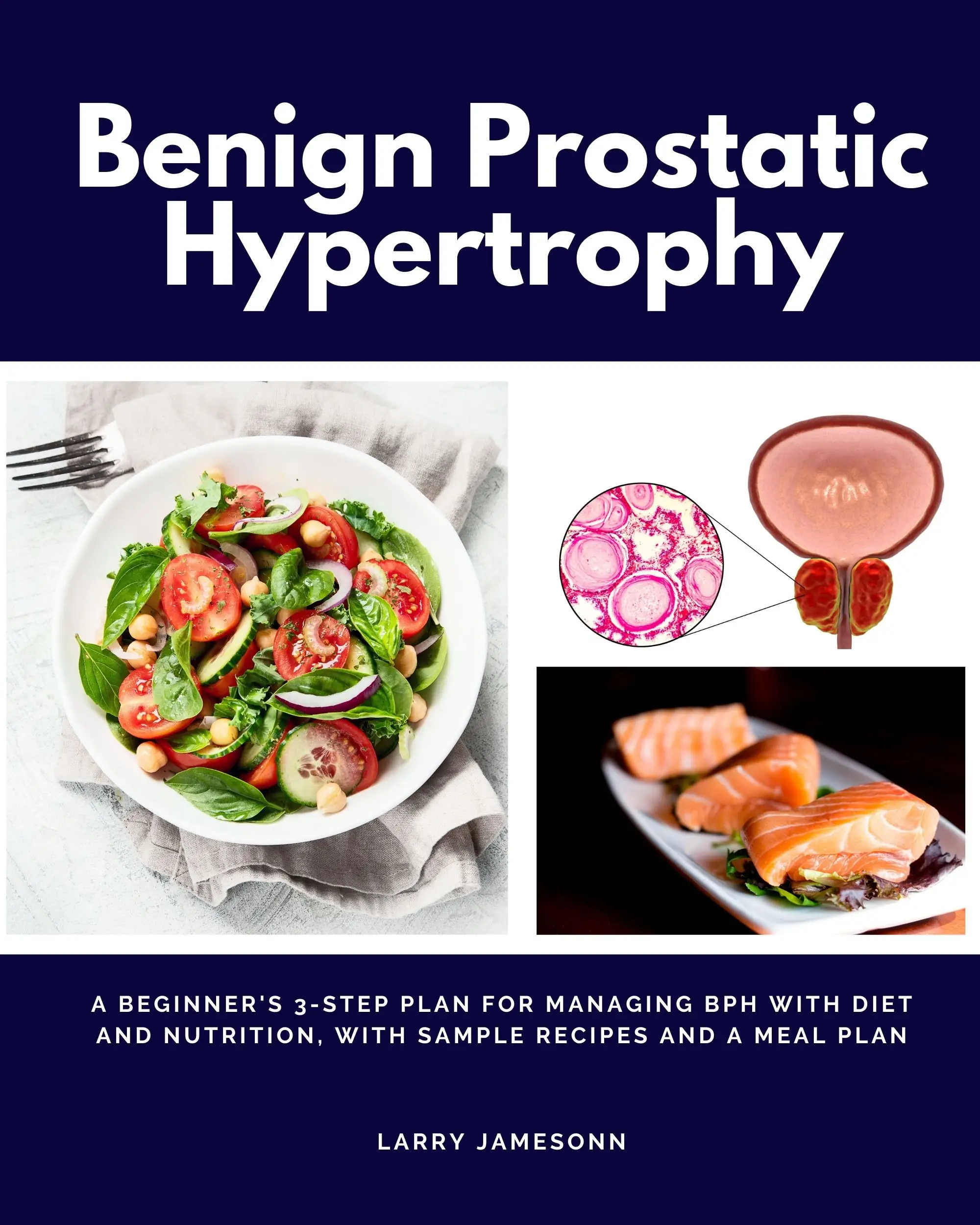 Benign Prostatic Hypertrophy