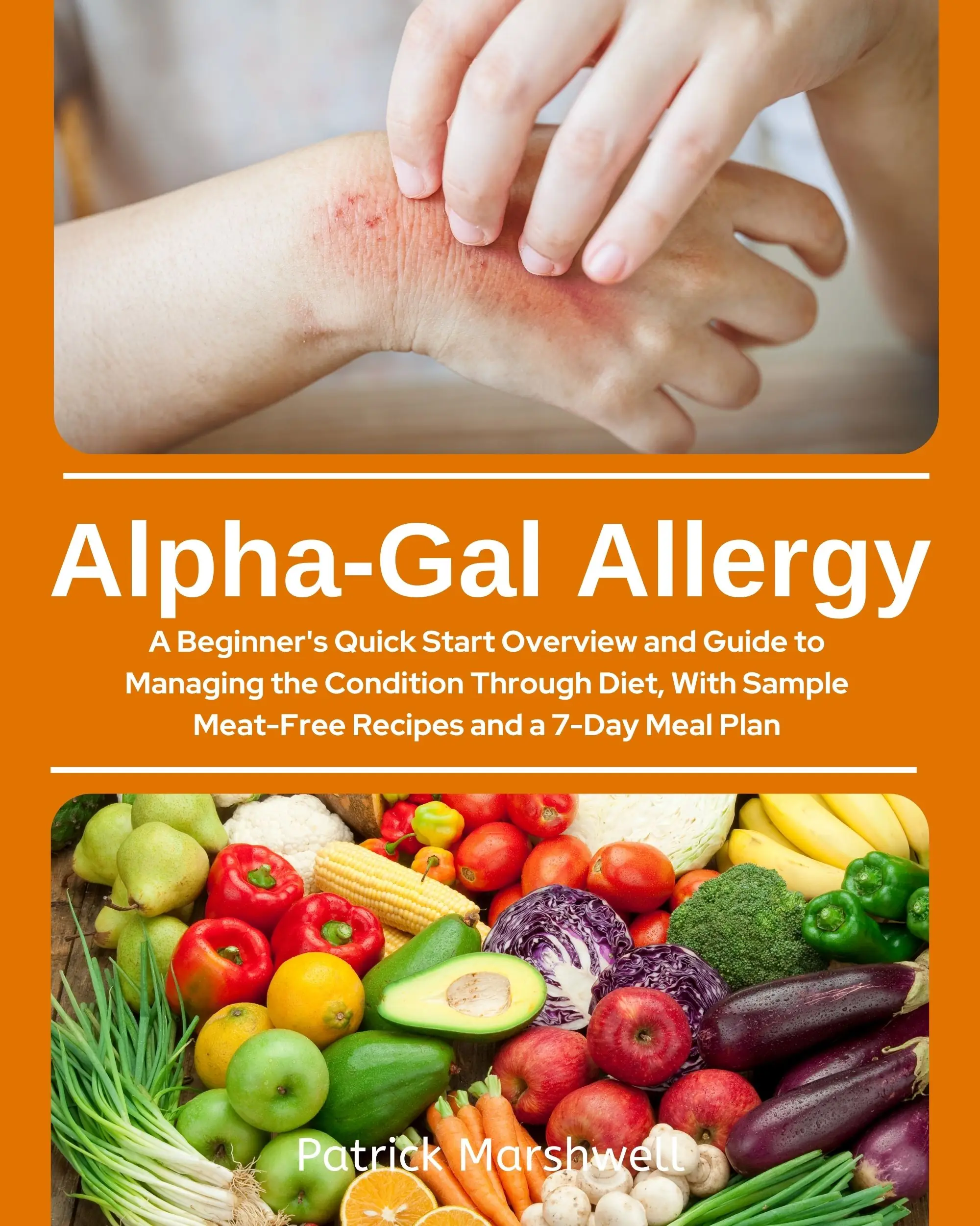 Alpha-Gal Allergy