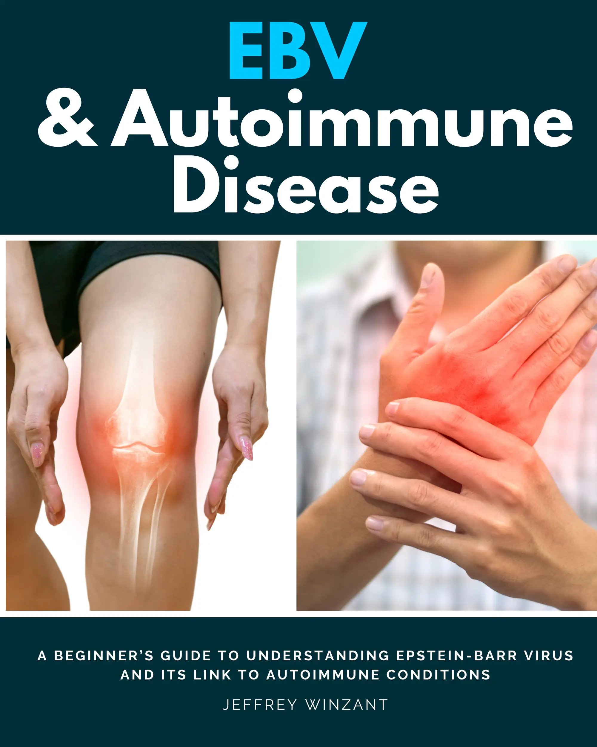 EBV & Autoimmune Disease