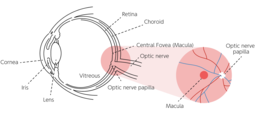 KalEYEdoscope: An Affordable, Remote Monitoring System for Tracking the Progression of Age-Related Macular Degeneration