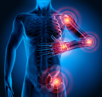 A Small Molecular Compound for Arthritis and Bone Erosion Treatment