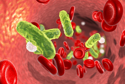 Synthetic High Density Lipoprotein for Treatment of Infections Complications