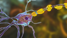 LIPID STORAGE DISEASE LIPID STORAGE DISEASE