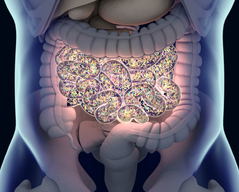 Modulating the Gut Microbiome to Treat Disease