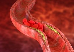 Soluble Urokinase Plasminogen Activator Receptor (SuPAR) as a Therapeutic Target for Prevention and Treatment of Atherosclerosis