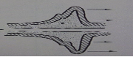 Local Pulsewave Velocity Measurement Using a Linear Array
