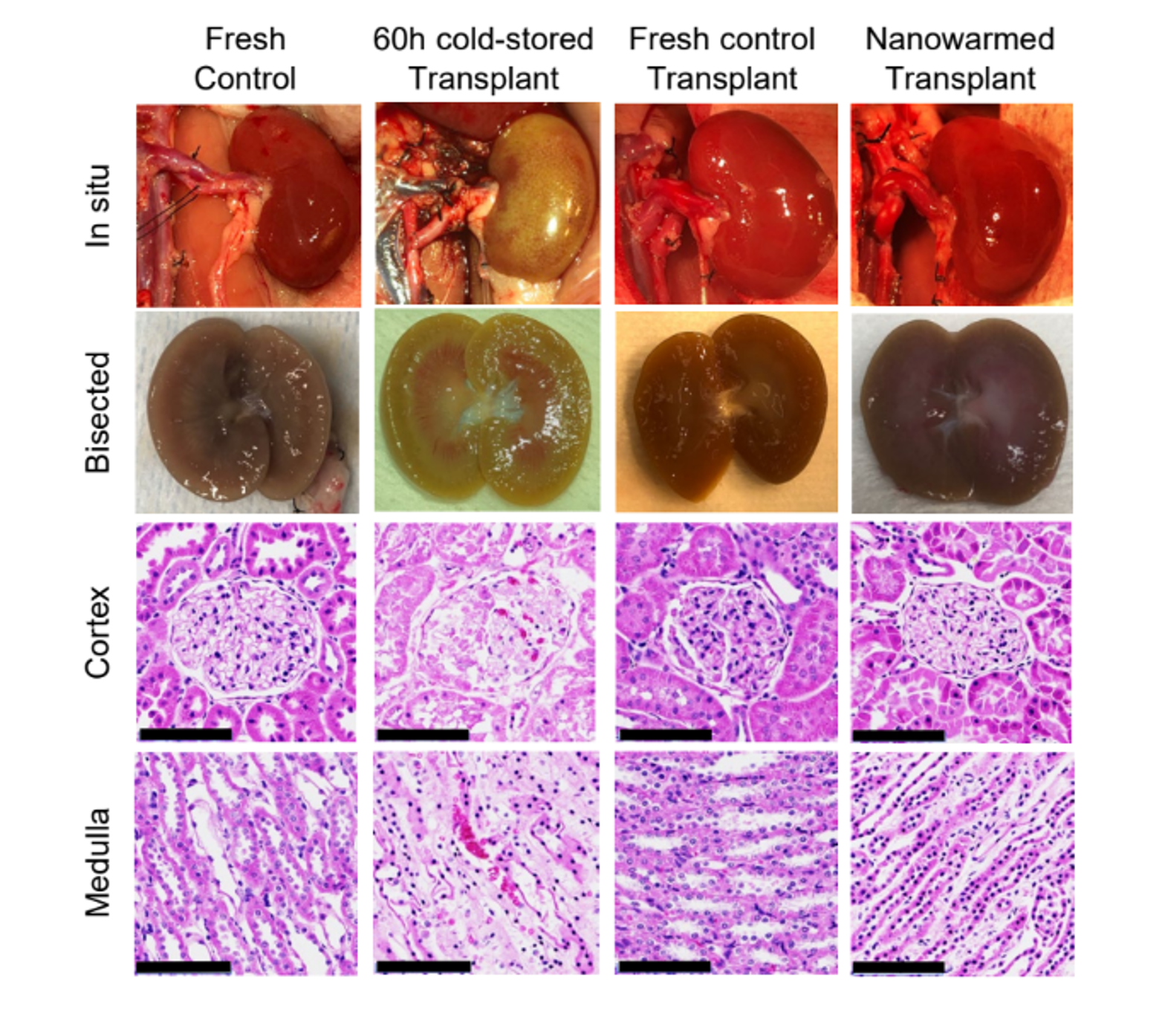 Gross and histologic appearance