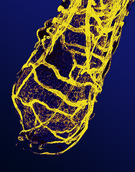 Vascular 3-D Network of the Bulb Region of an Actively-Growing Anagen Human Scalp Hair Follicle