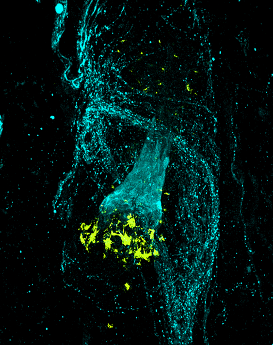 Melanocytes and Nerves of a Human Anagen Scalp Hair Follicle