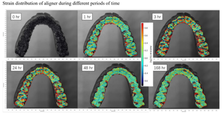 Orthodontic teeth aligners enabling deeper analysis and personalized treatment plans (2020-227, Dr. Alex Fok)