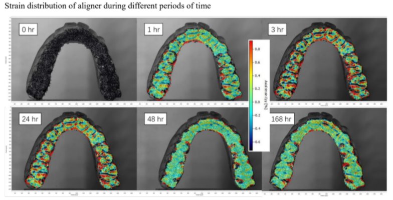 Orthodontic teeth aligners enabling deeper analysis and personalized treatment plans