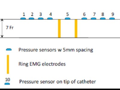 Multifunctional, flexible sensor array for urethral catheters (20140233)