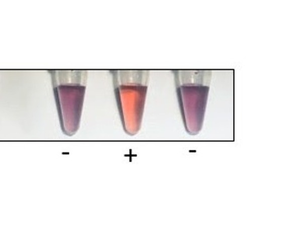 Assay for detecting misfolded proteins