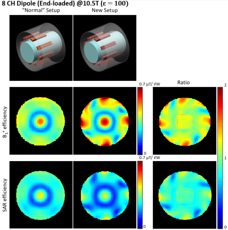 MRI RF coil for improved field efficiency and image quality