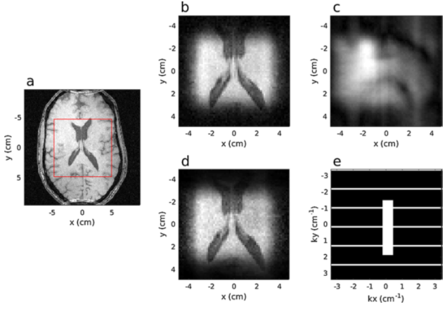 Accelerating MRI data acquisition with segmented 2D pulses Accelerating MRI data acquisition with segmented 2D pulses