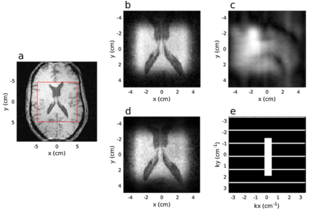 Accelerating MRI data acquisition with segmented 2D pulses