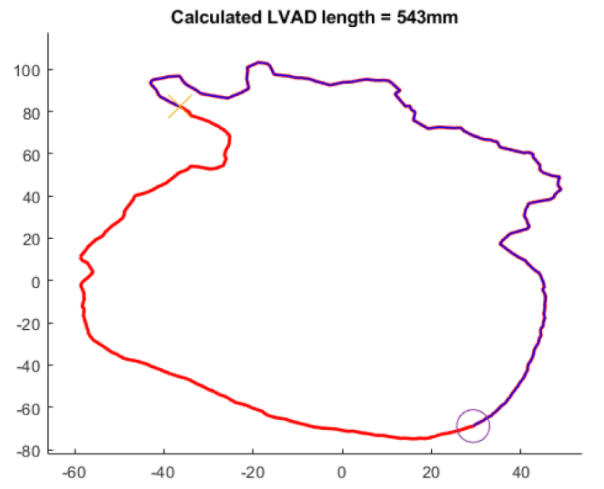 Algorithm to improve left ventricular assist device implantation