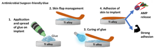 Multi-faceted glue for long-term survival of osseointegrated prosthetic devices Multi-faceted glue for long-term survival of osseointegrated prosthetic devices