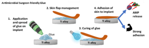 Multi-faceted glue for long-term survival of osseointegrated prosthetic devices