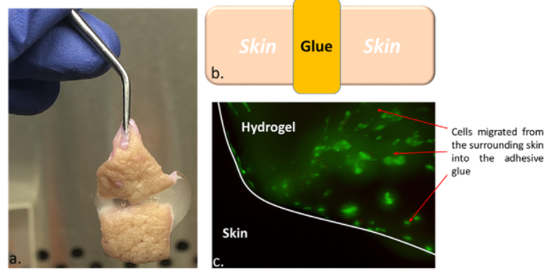 Multi-faceted glue for long-term survival of osseointegrated prosthetic devices Multi-faceted glue for long-term survival of osseointegrated prosthetic devices