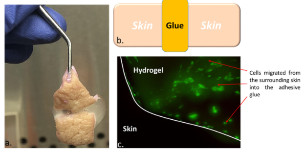 Multi-faceted glue for long-term survival of osseointegrated prosthetic devices