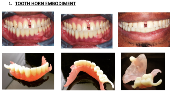 Advanced manufacturing method to fabricate removable partial denture