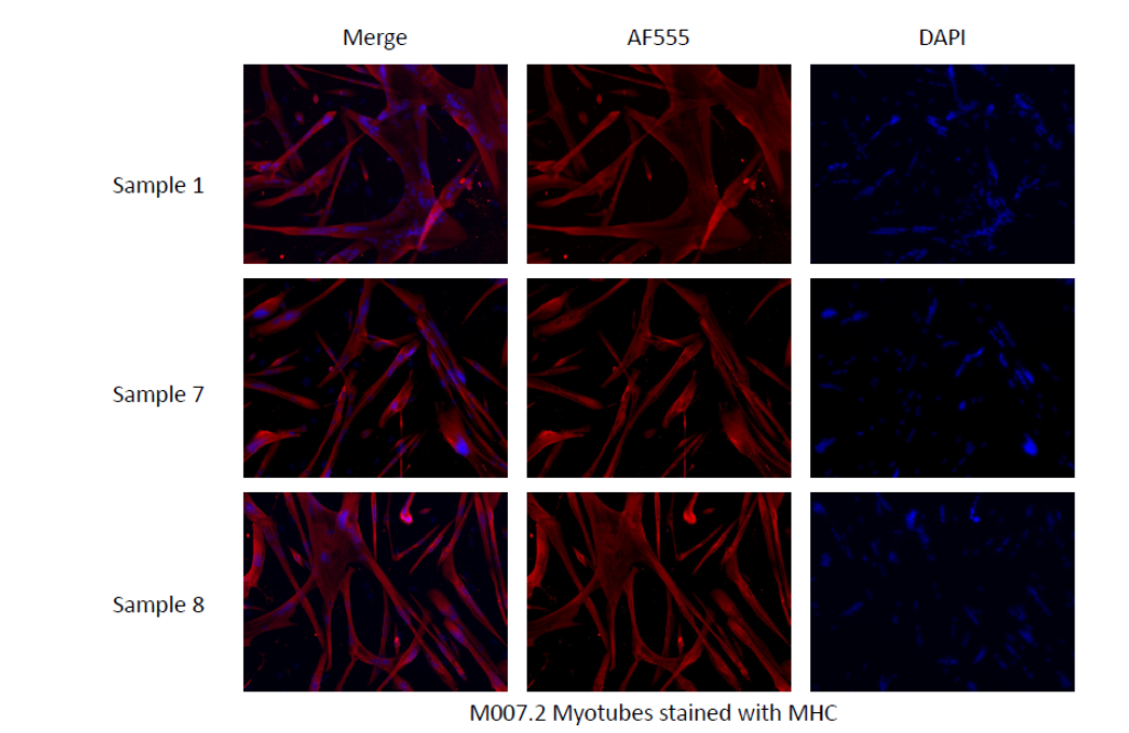 M007.2 Myotubes stained with MHC