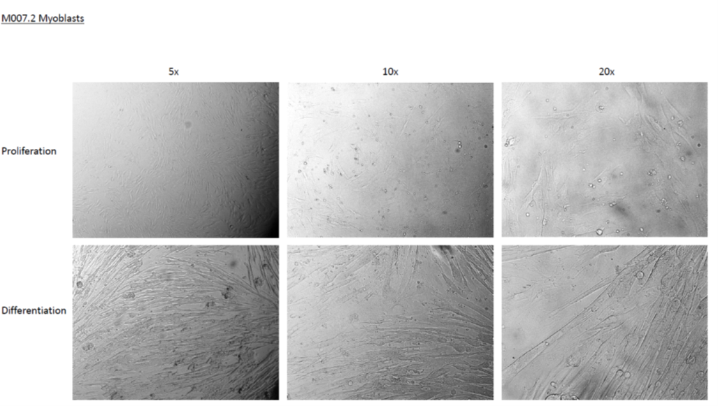 M007.2 Myoblasts