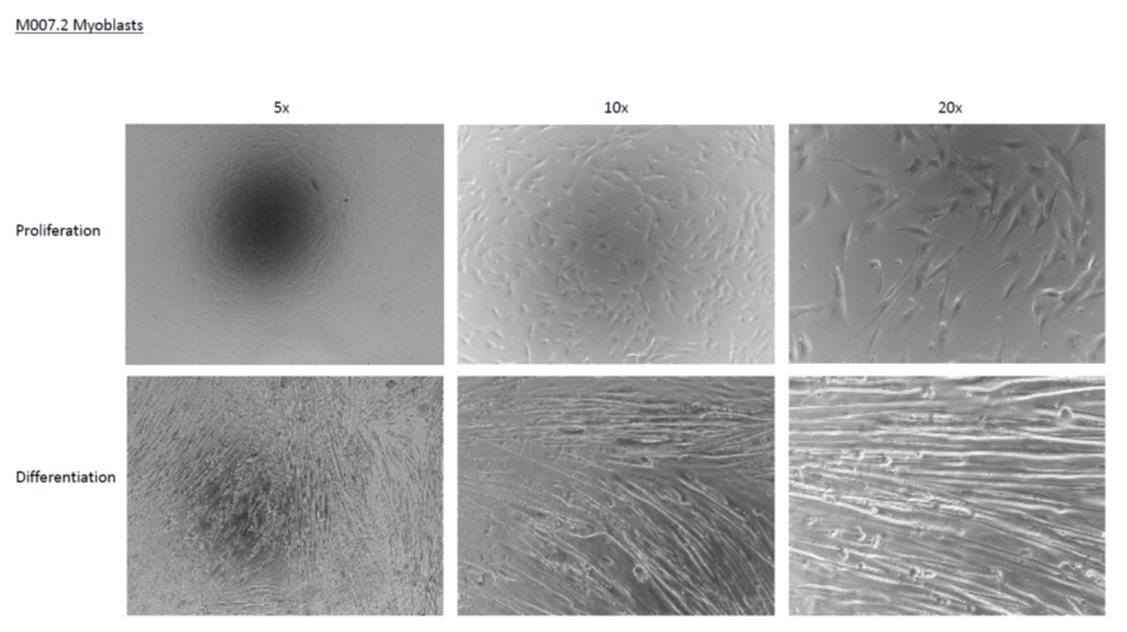 M007.2 Myoblasts