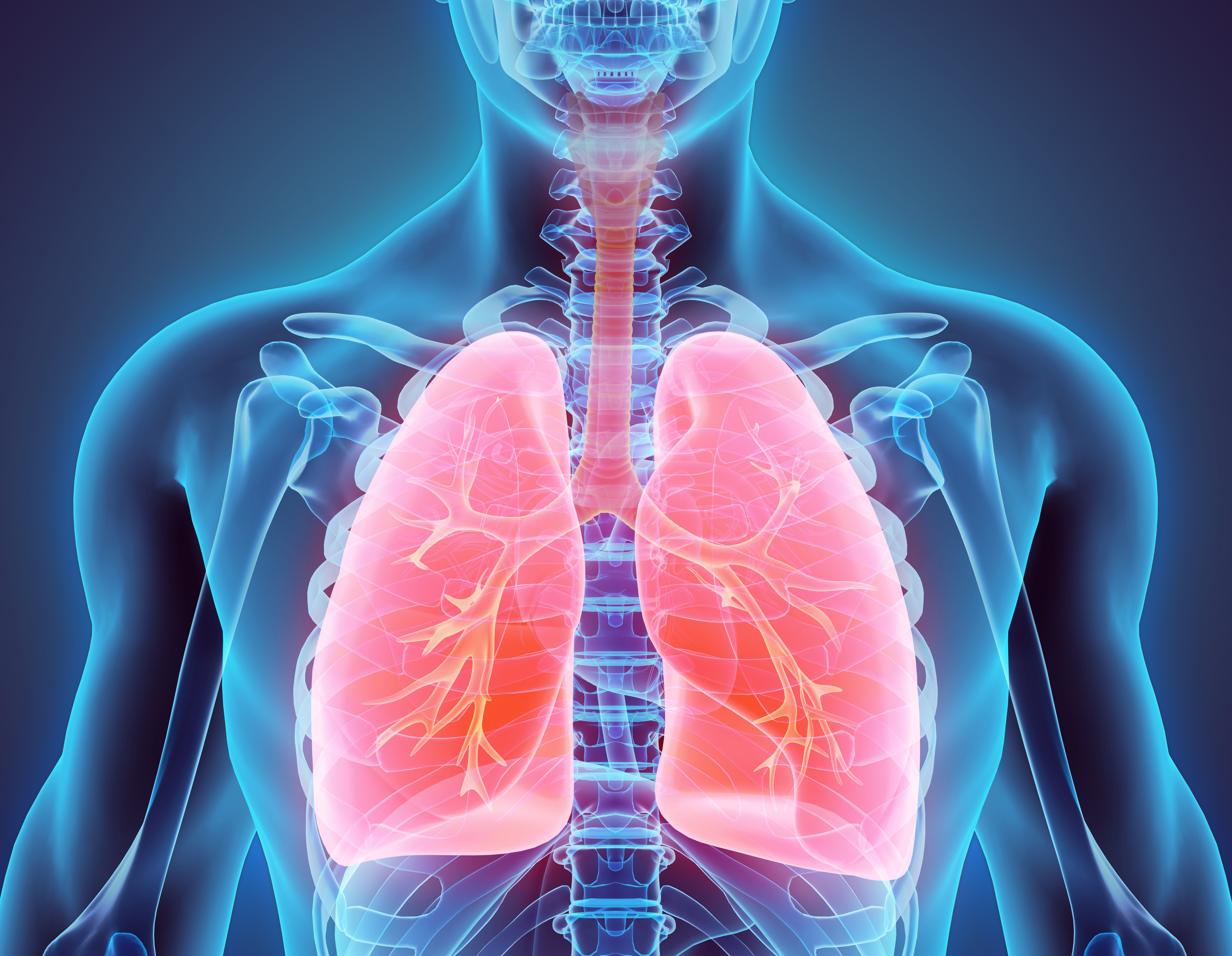 A Novel Blood Marker for Prognostication and Treatment of Non-Small Cell Lung Cancer