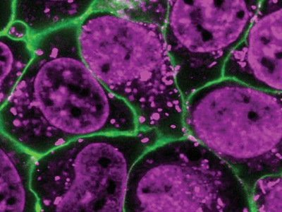 Photoactivatable Lipid Nanoparticles for Drug Delivery