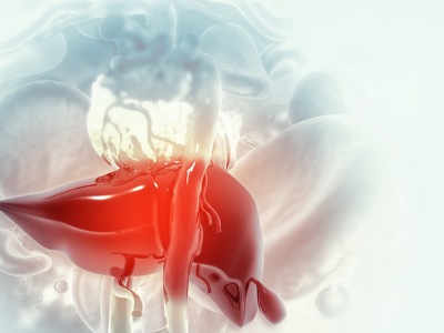 Chimeric FGF21: Treatment of NAFLD, NASH and Hepatic Steatosis