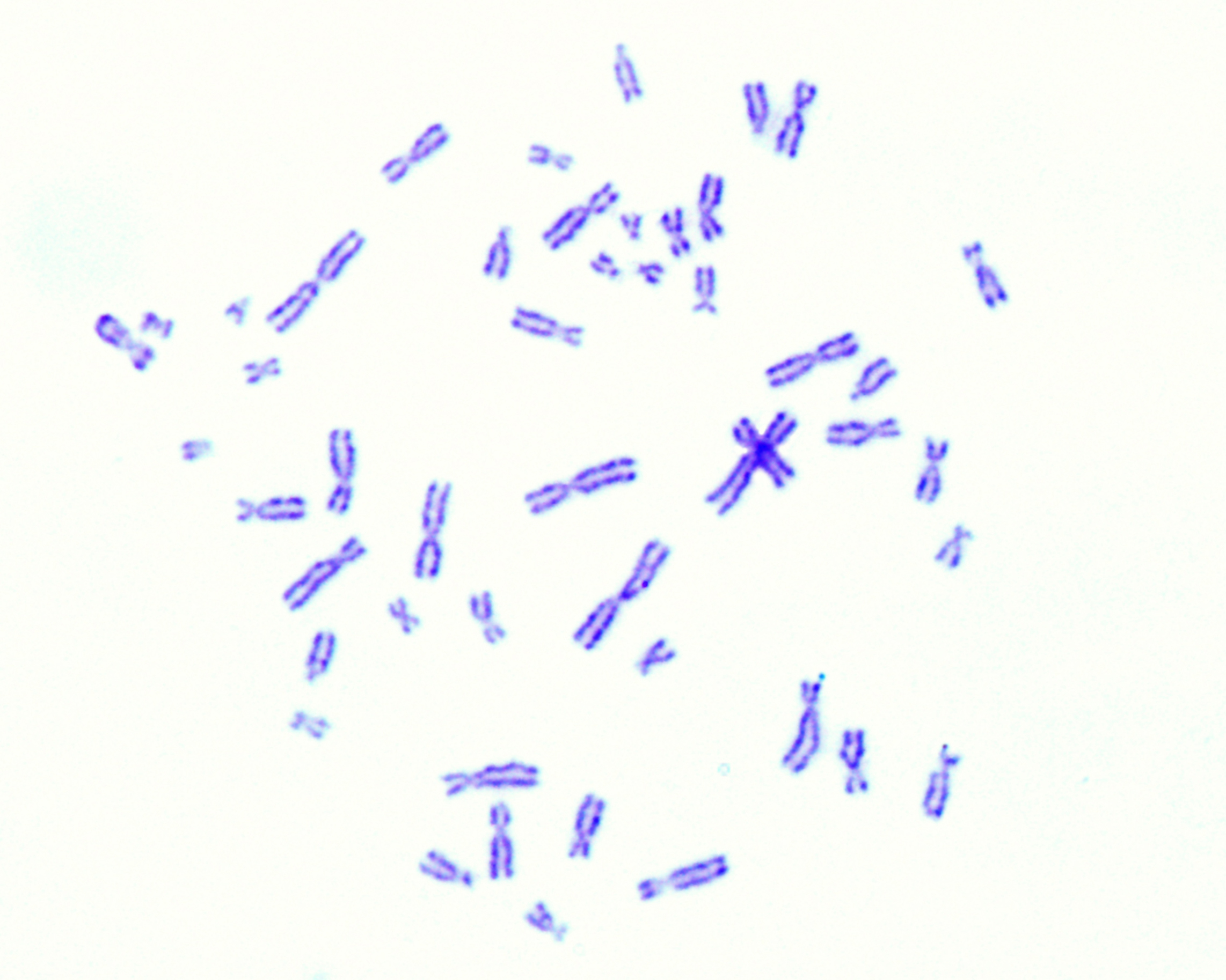 KaryoCreate (Karyotype CRISPR Engineered Aneuploidy Technology)