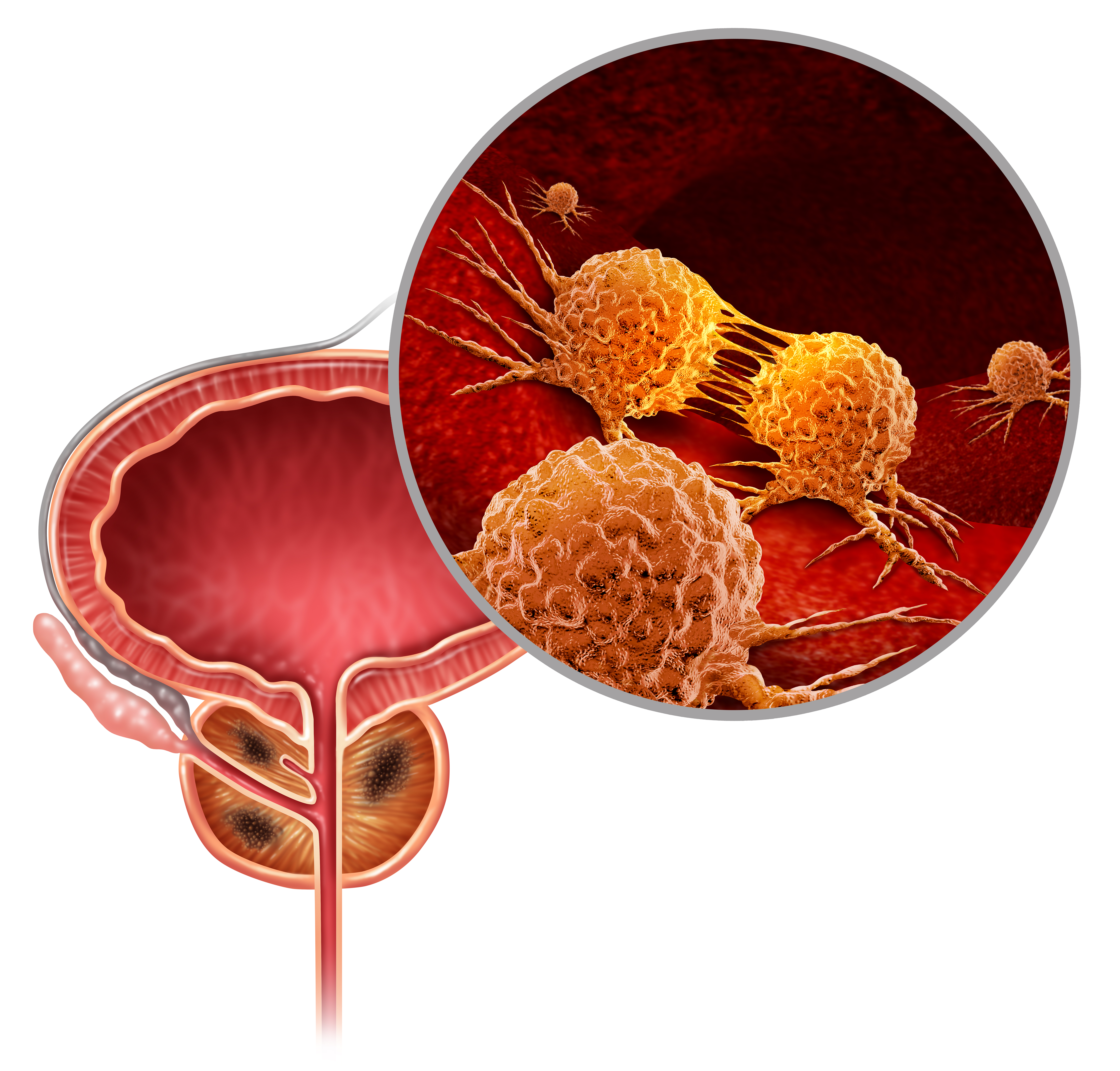 Peptidomimetic-Steroid Conjugates for Castration-Resistant Prostate Cancer (CRPC) Treatment